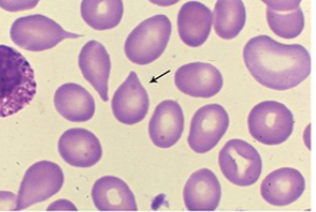 <p>what cells are these?</p>