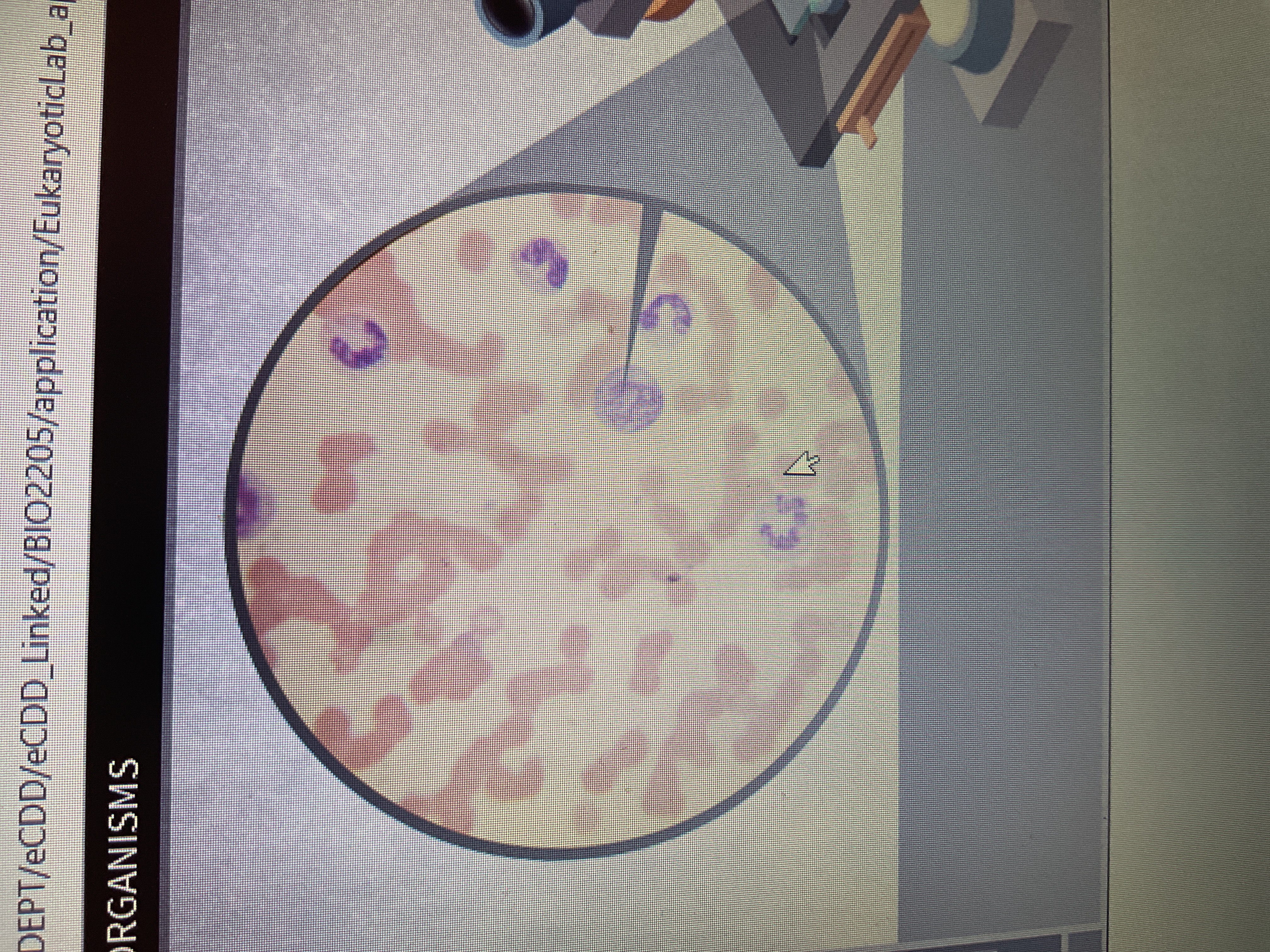 <p>Protozoa</p><p>Plasmodium</p><p>Liver then transitions to RBCS from mosquitos</p>