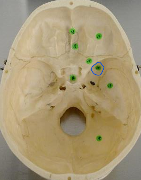 <p>#15 (internal skull)</p>
