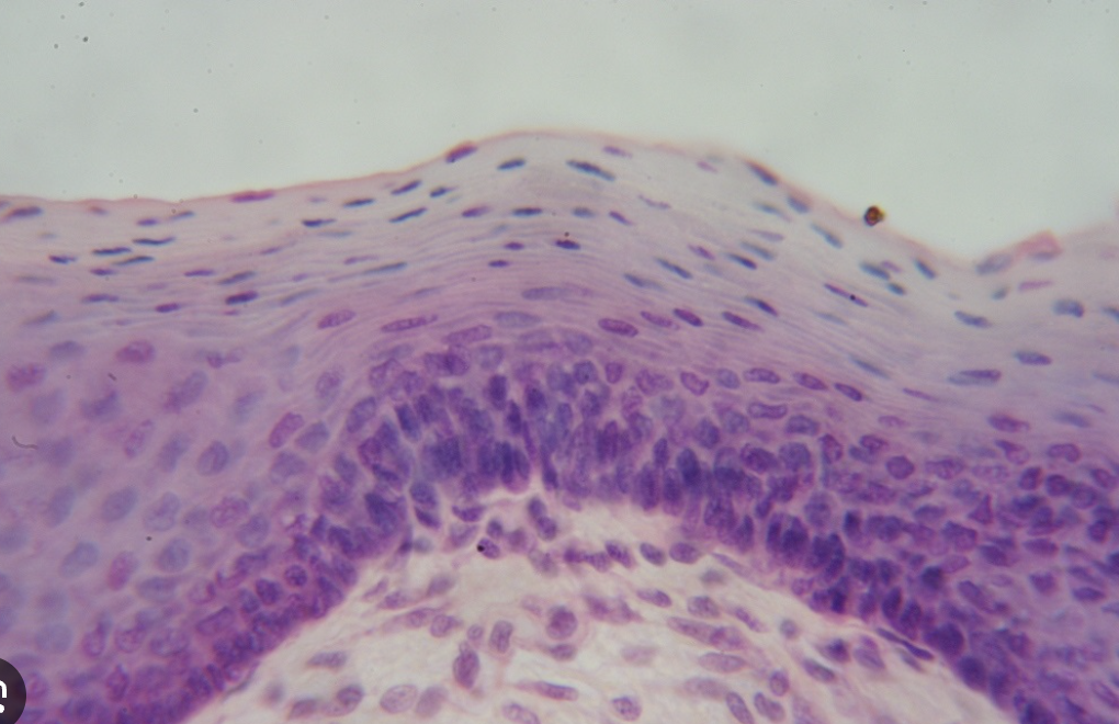 <p><span>stratified squamous epithelium</span></p>