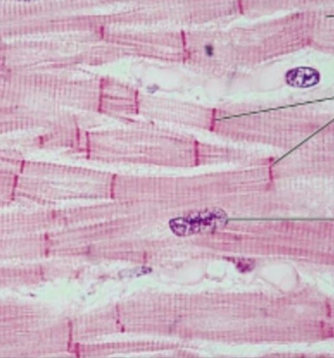 <p>What type of tissue is this?</p>
