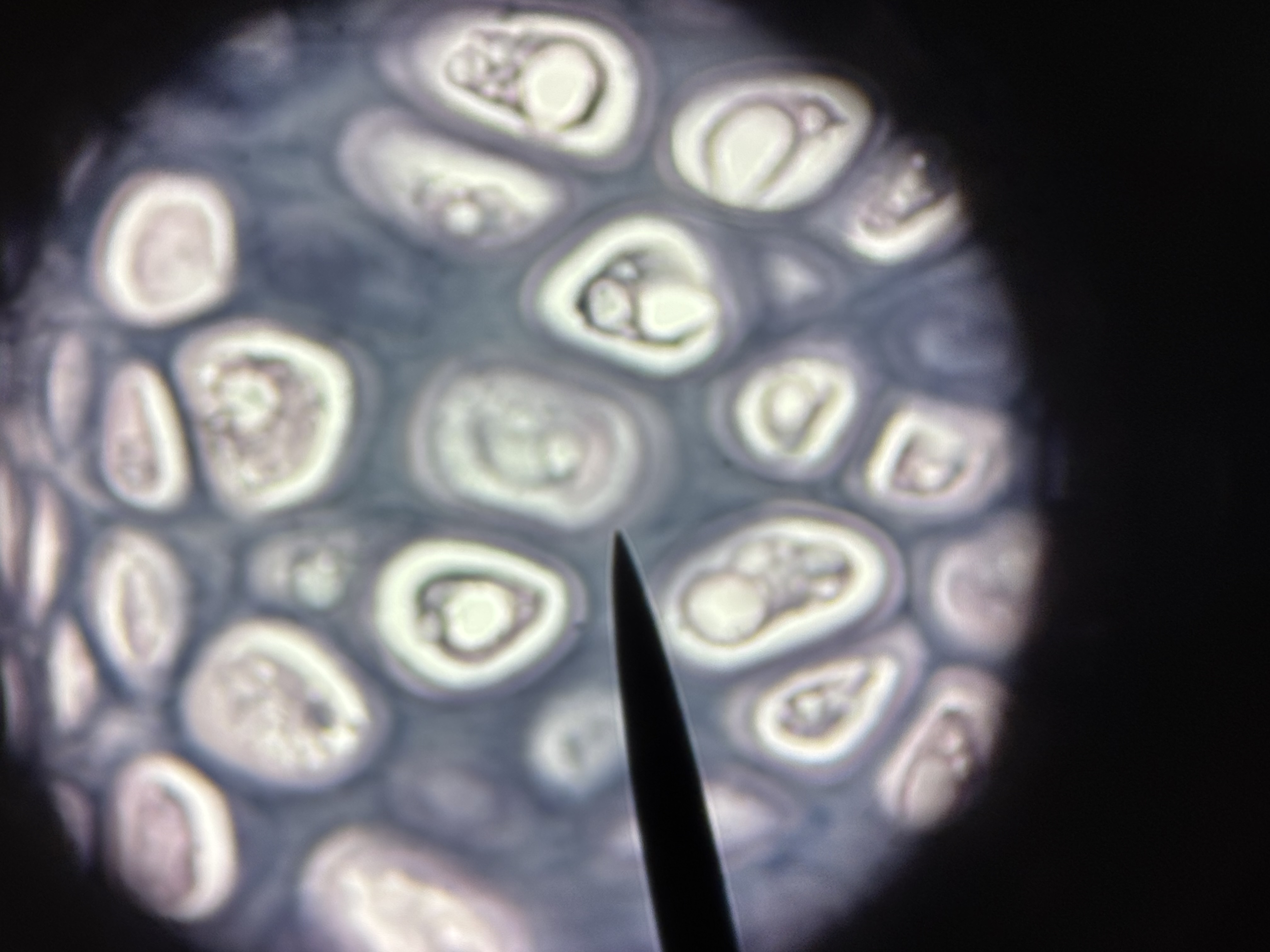 <p><span>Elastic cartilage</span></p>