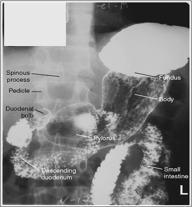 <p>What position is this patient in?</p>
