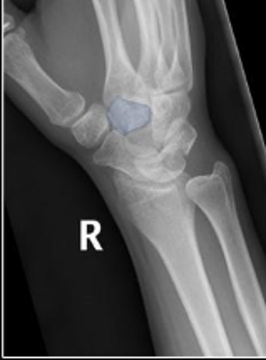 <p>What is outlined?</p>