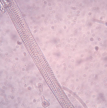<p>Is this muscle fiber relaxed or contracted?</p>