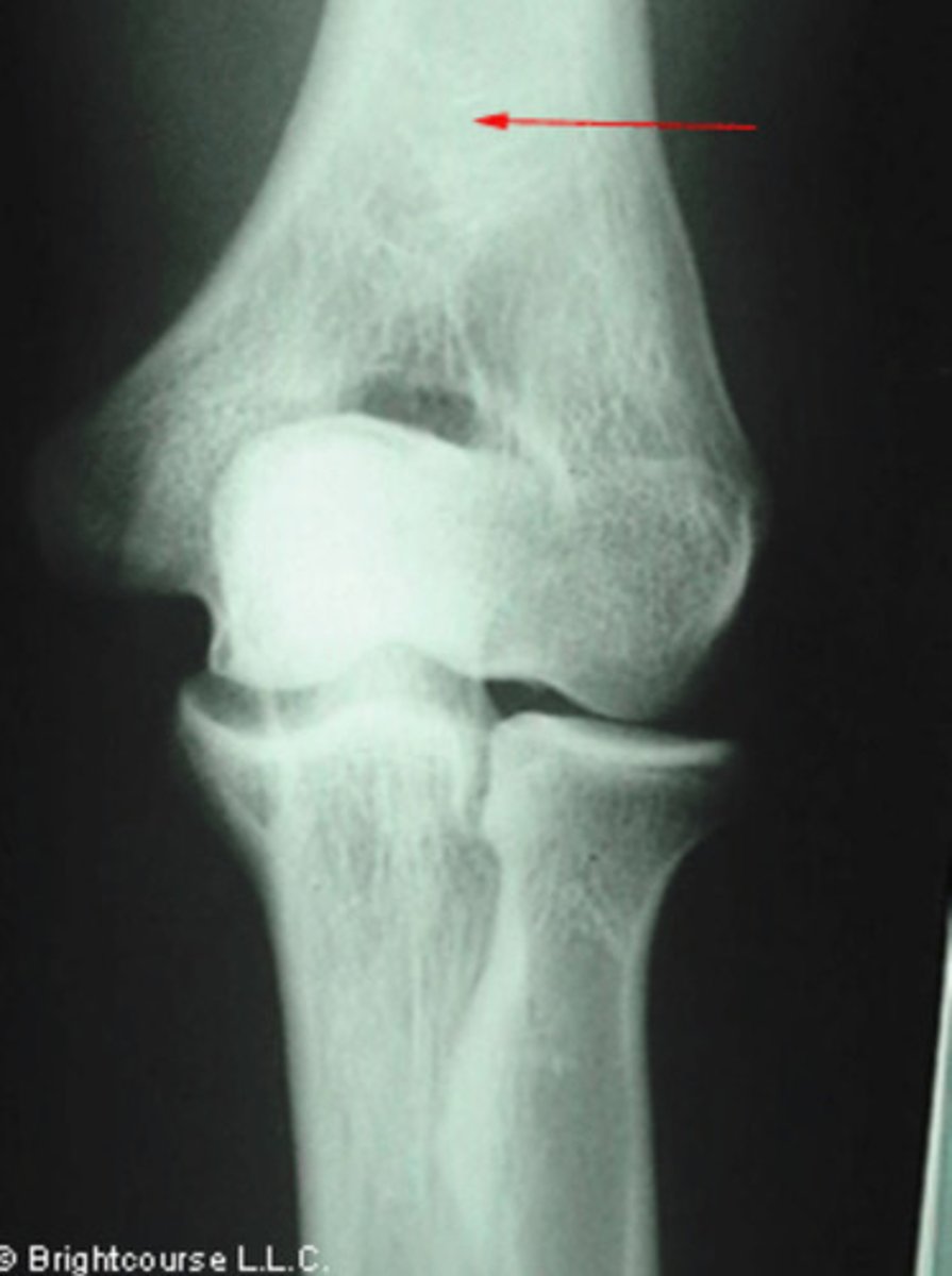 <p>What structure is being pointed out by the arrow?</p>