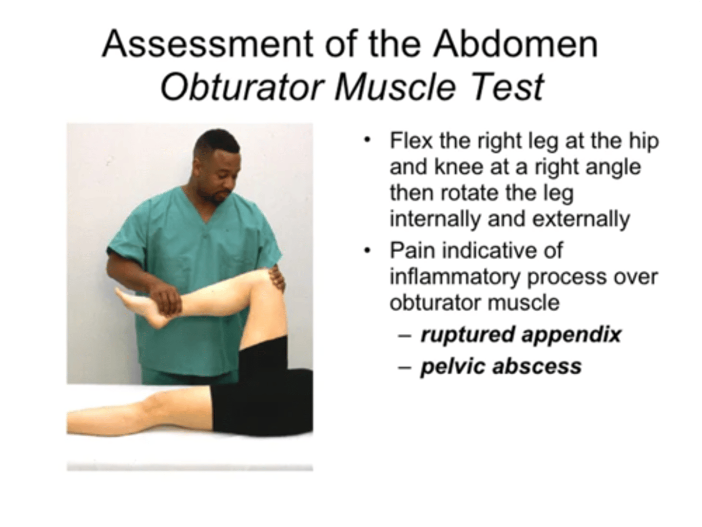 <p>flex the right leg at the hip and knee at a right angle then rotate the leg internally and externally </p><p>pain indicative of inflammatory process over obturator muscle </p><p>--ruptured appendix</p><p>--pelvic abscess</p>