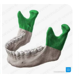 <p>coronoid process - and ascending rami on both sides????</p>