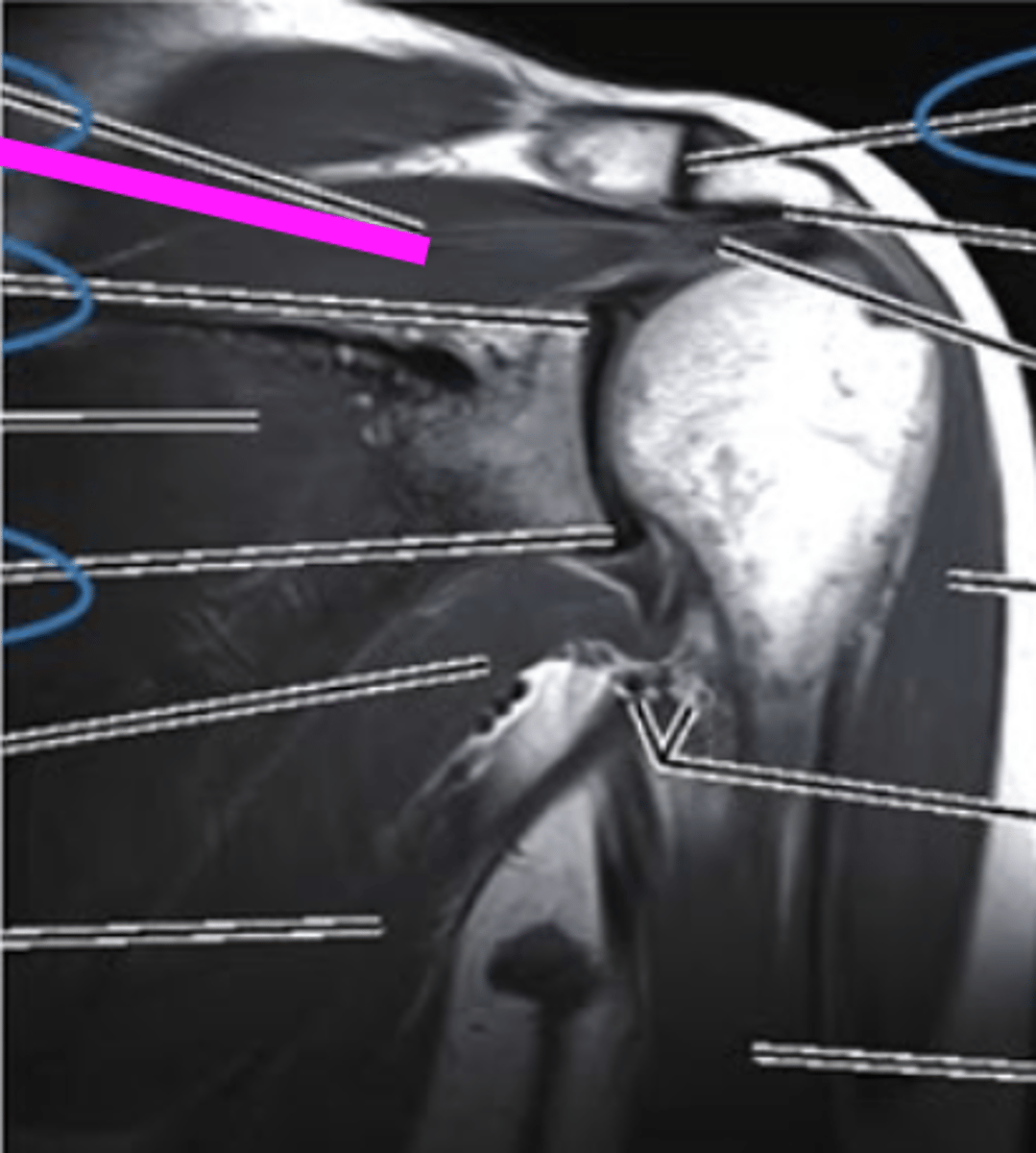 <p>what does the pink line point to?</p>