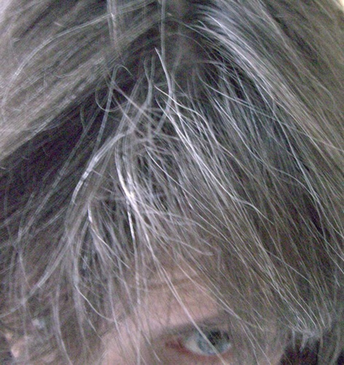 <p>technical term for gray hair; results from the loss of the hair's natural melanin pigment.</p>
