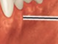 <p>What is the name of this bone in the skull?</p>