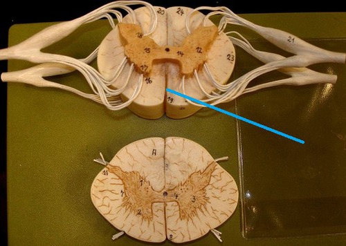a deep cleft on the anterior side of the spinal cord partially separating the left and right halves