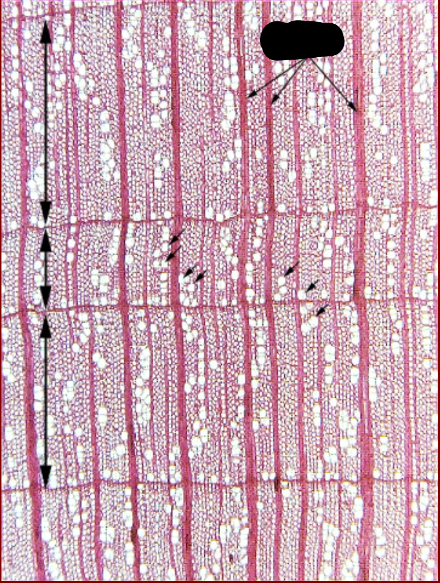 <p>What cell is this? Trace it back to its meristem and give the function </p>
