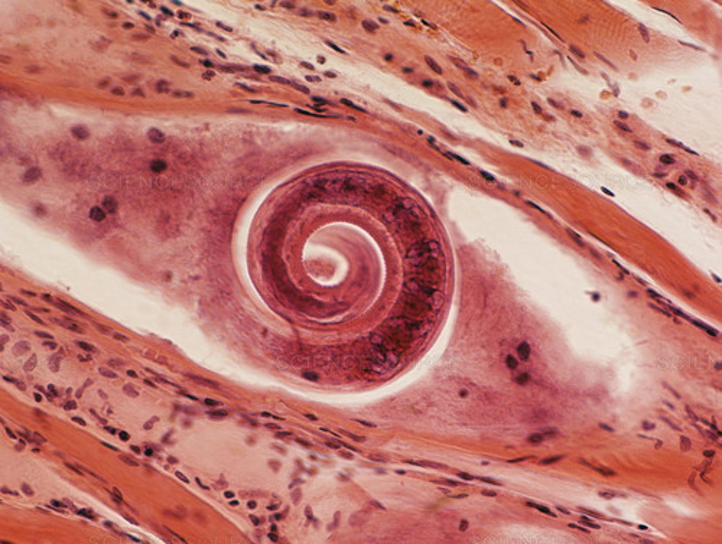 <p>This parasite encysts in muscle tissue and is nonpathogenic to its porky host.</p>