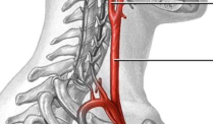 <p>supplies right side of head</p>