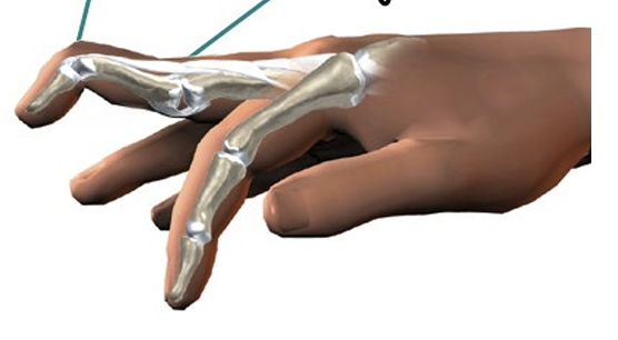 <p>What deformity is this and what disease is this from </p>