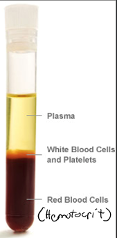 <ul><li><p>Fluid (non-living) portion of blood</p></li><li><p>When blood is centrifuged, it is the clearish yellow portion</p></li><li><p>Composition</p><ul><li><p>90% water</p></li><li><p>6 solutes found in plasma</p><ul><li><p>Electrolytes</p></li><li><p>Nitrogenous substance (urea, uric acid, etc)</p></li><li><p>Organic nutrients (glucose, amino acids, triglycerides, etc.)</p></li><li><p>Respiratory gases</p></li><li><p>Hormones</p></li><li><p>Plasma proteins</p></li><li><p>Every night owl really hates possums</p></li></ul></li></ul></li></ul><p></p>