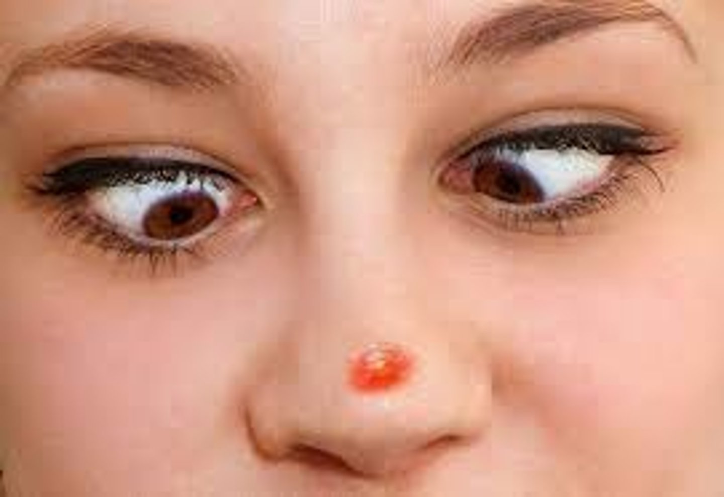 <p>недолік</p>