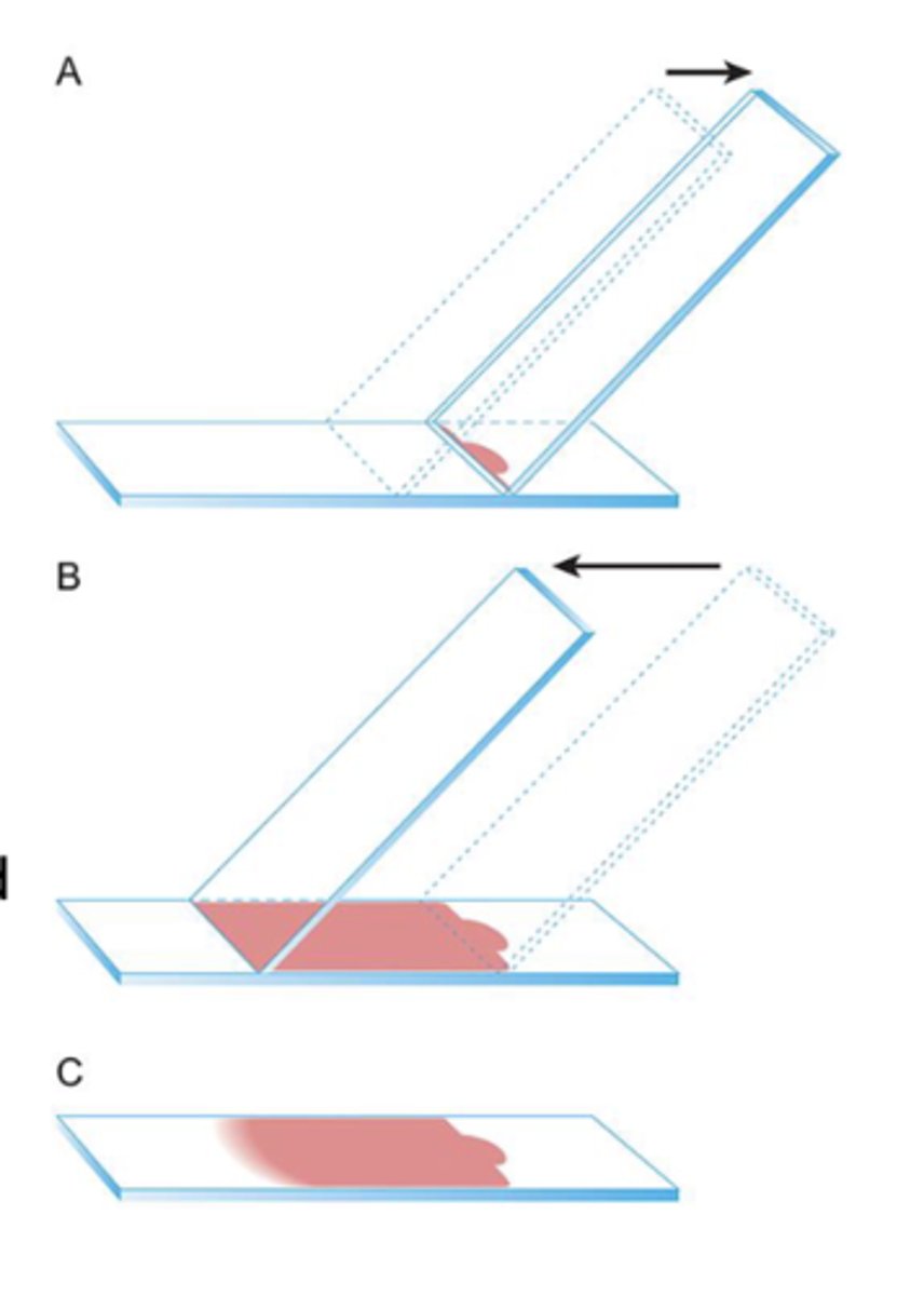 <p>What slide prep method is this?</p>