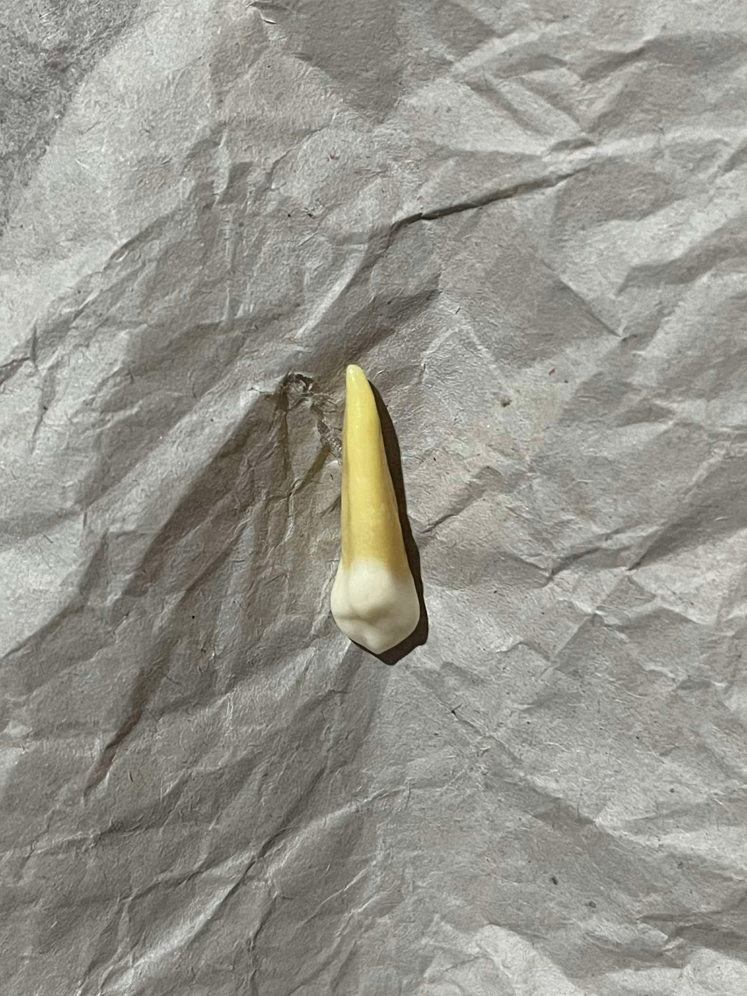 <p>What tooth is this (with view)?</p>