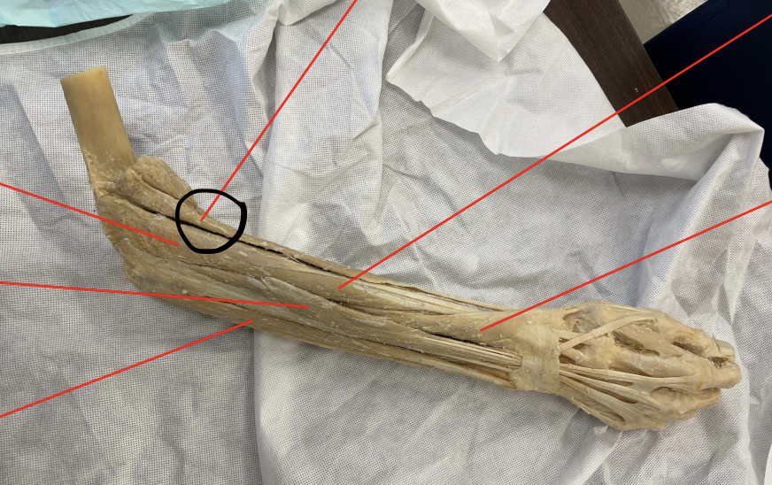 <p>identify + state origin, insertion, action, innervation of marked structure</p>