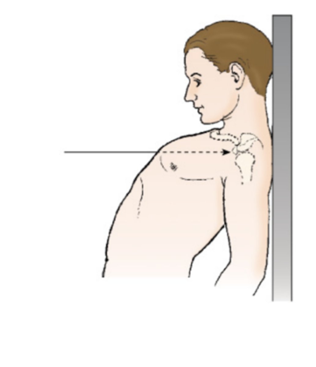 <p>upright position in which the patient is leaning backward</p><p>radiographic position of the chest results</p><p>in an AP axial projection. Note that the central</p><p>ray is not angled; however, it enters the chest</p><p>axially as a result of body position.</p>