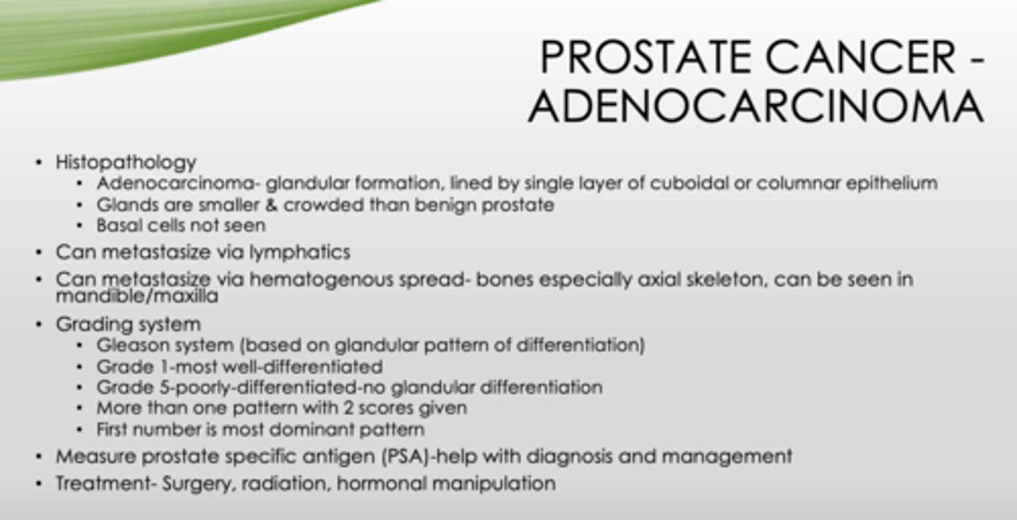 <p>Prostate cancer (adenocarcinoma)</p>