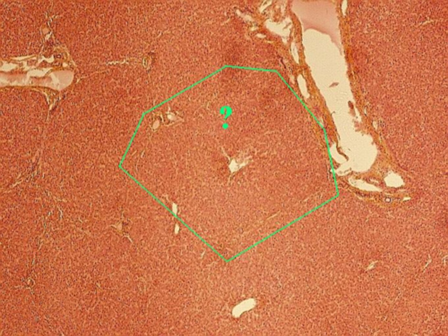 <p>Identify the indicated structure in the liver.</p>