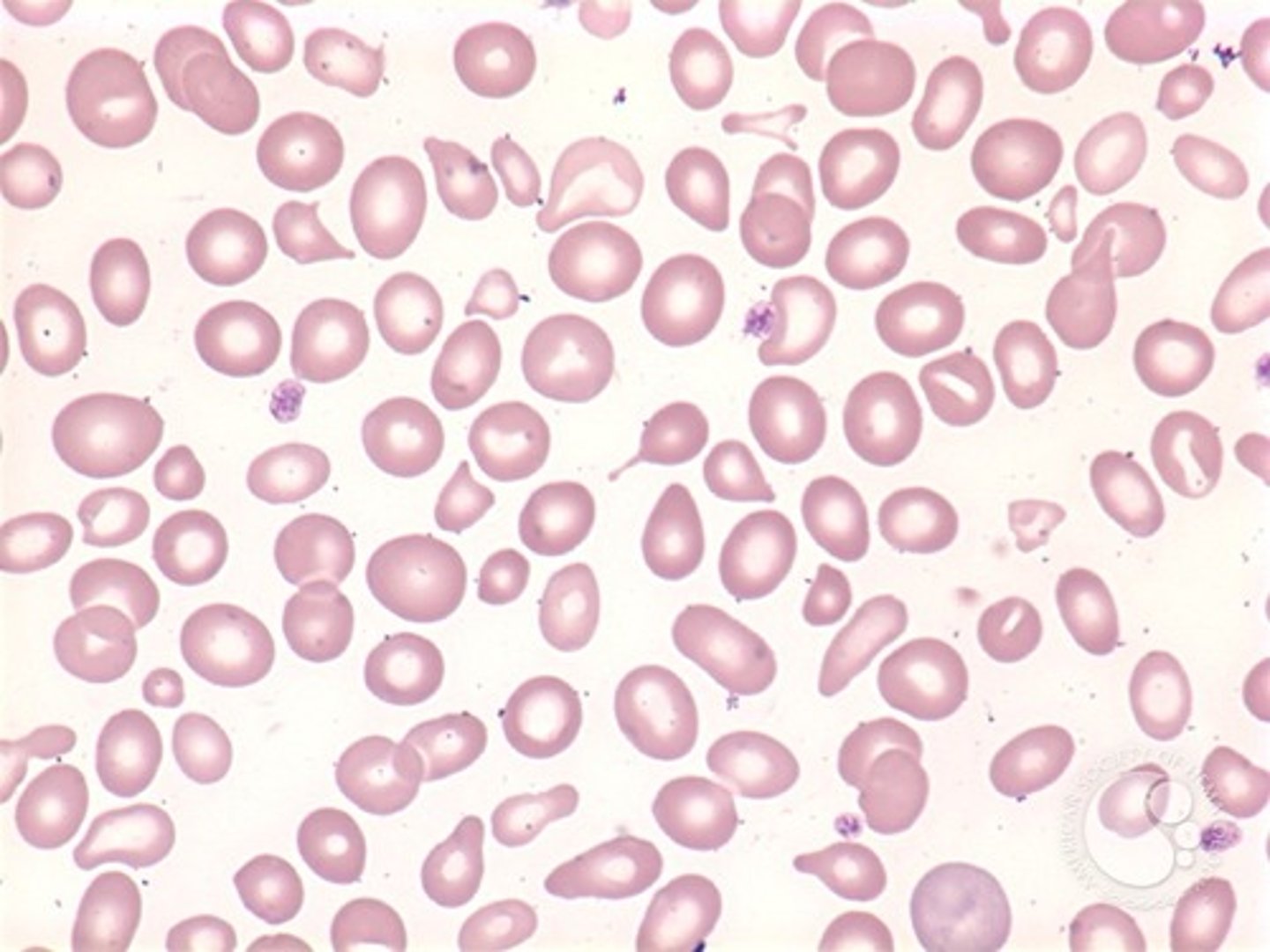 <p>increased variation in RBC shape</p><p>(cell shape)</p>