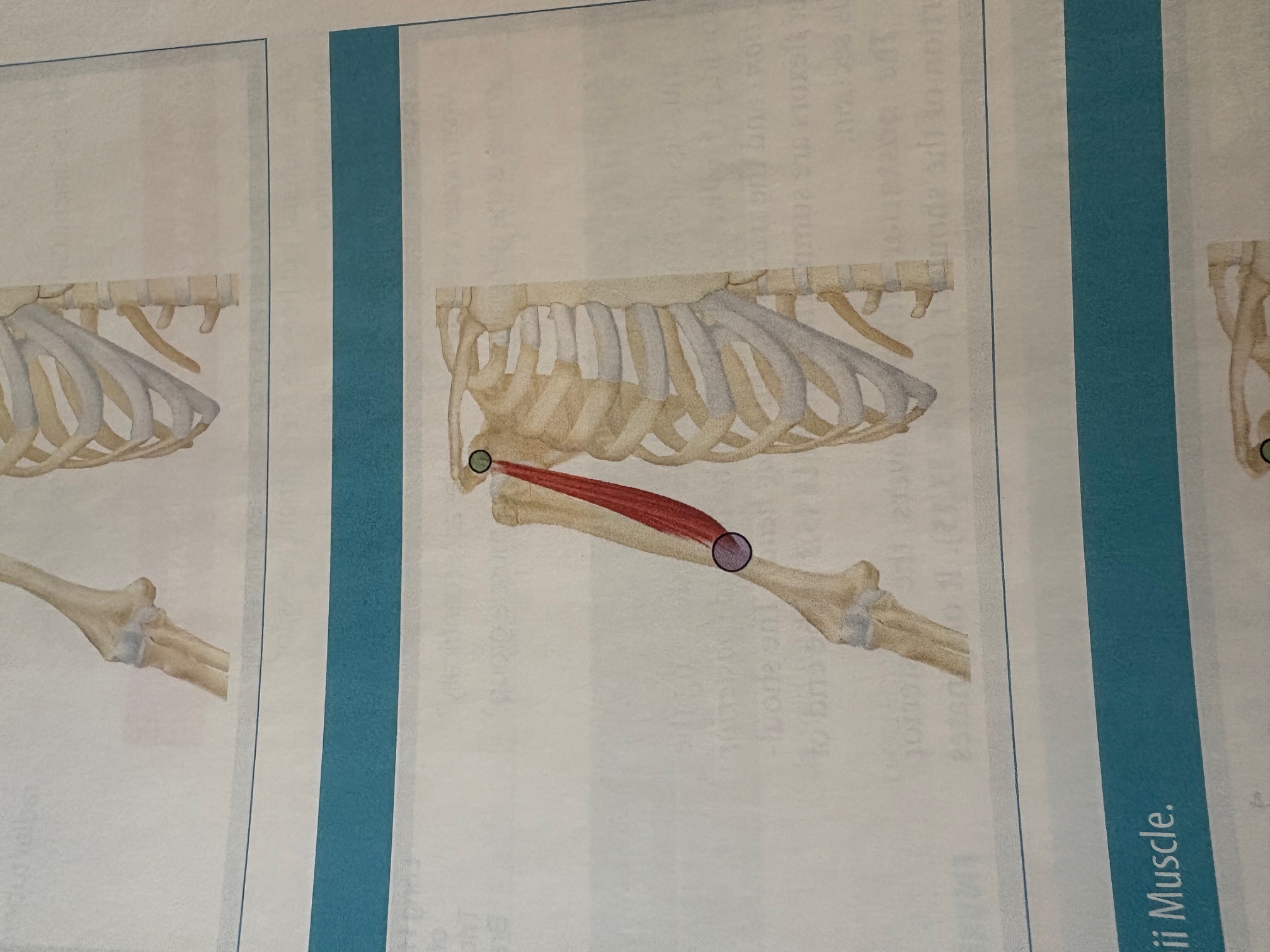 <p>Coracobrachialis </p>