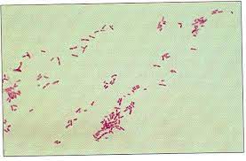 <p>What am i- gram stain, shape, arrangement</p>