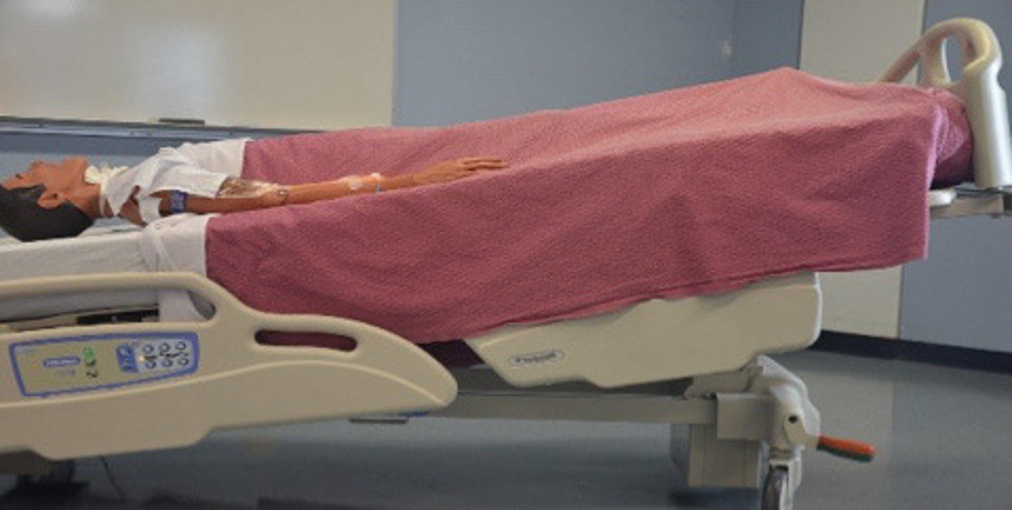 <p>the patient is lying flat on the back, and the entire examination table is tilted with the head of the table down. This position is used for therapeutic treatments, such as postural drainage in patients who have thick respiratory secretions.</p>