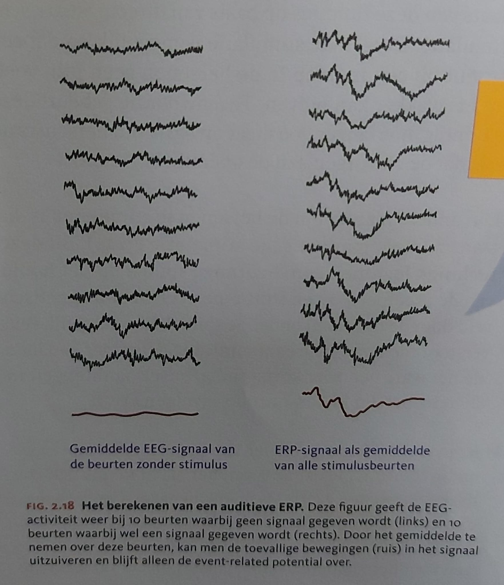 <p>De electrische activiteit als reactie op specifieke prikkel</p><ul><li><p>Door herhaaldelijk zelfde stimulussoort aan te bieden → gemiddelde, daardoor kunnen toevallige bewegingen (ruis) in signaal uitgezuiverd worden.</p></li><li><p>Kijken hoesnel hersenen reageren en oppiken en een idee van plaats waar signaal ongeveer vandaan komt (hersenscans zijn beter). Op basis hoe signaal veranderd → uitspraak welke processen een rol hebben.</p></li></ul><p>(Elektrische activiteit)</p>