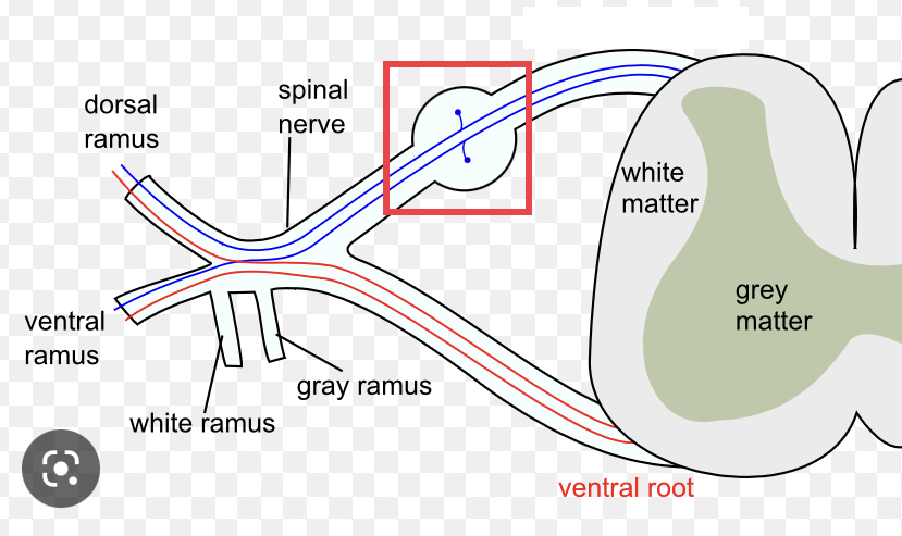 sensory ganglion attached to the posterior nerve root of a spinal nerve