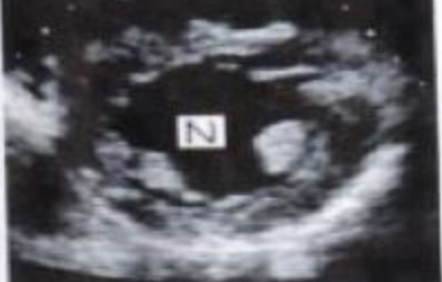 <p>N?</p>