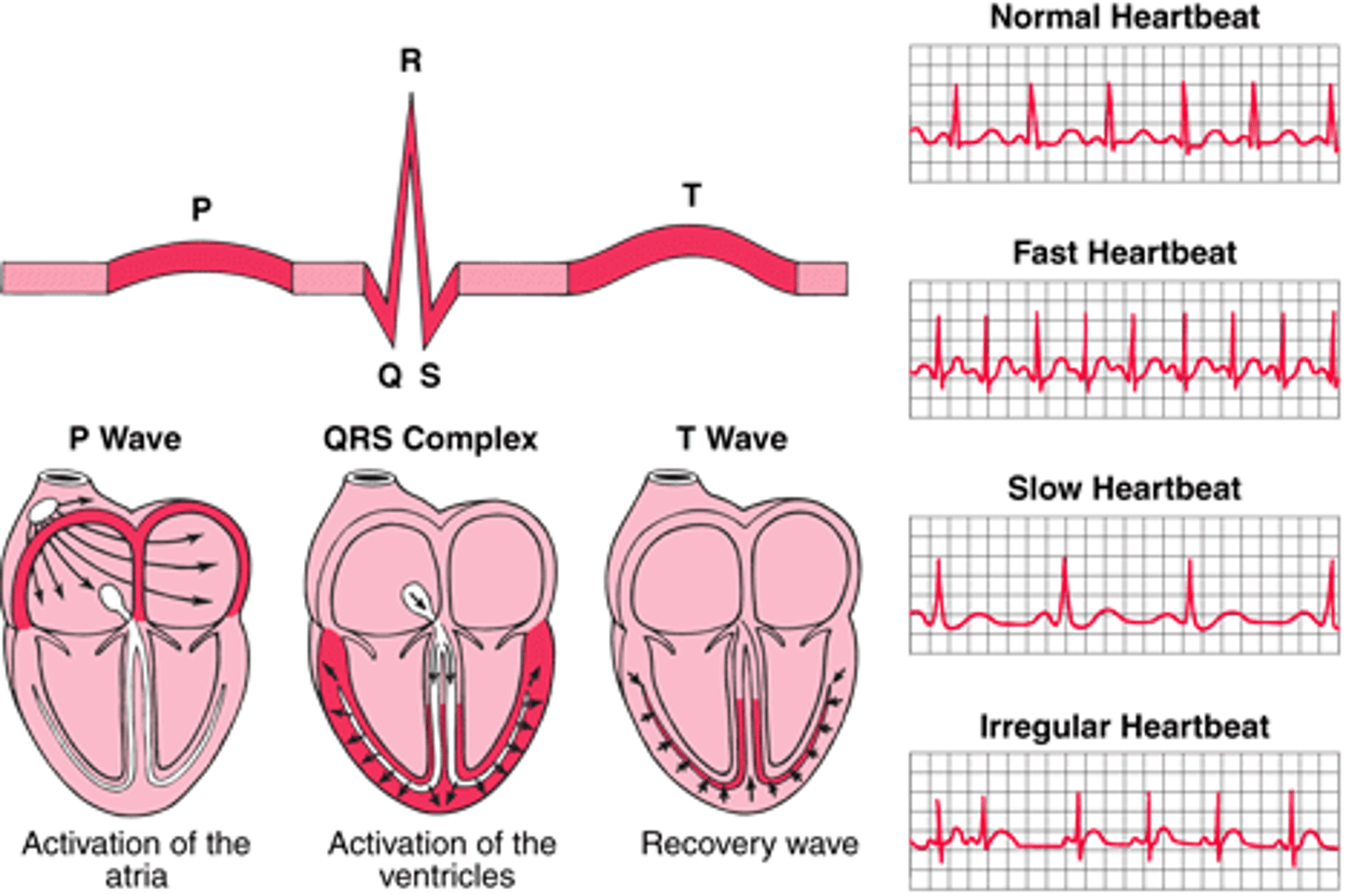 <p>Electrocardiogram measuring heart's electrical activity.</p>