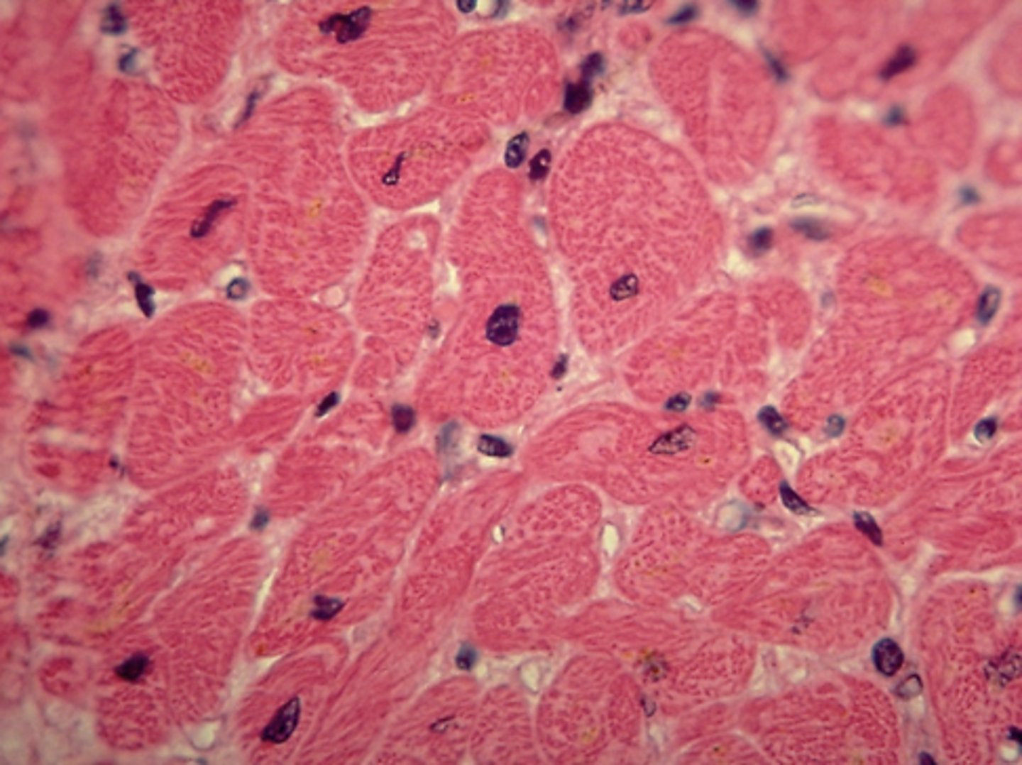 <p>Which type of striated muscle tissue is presented in the following image:</p>