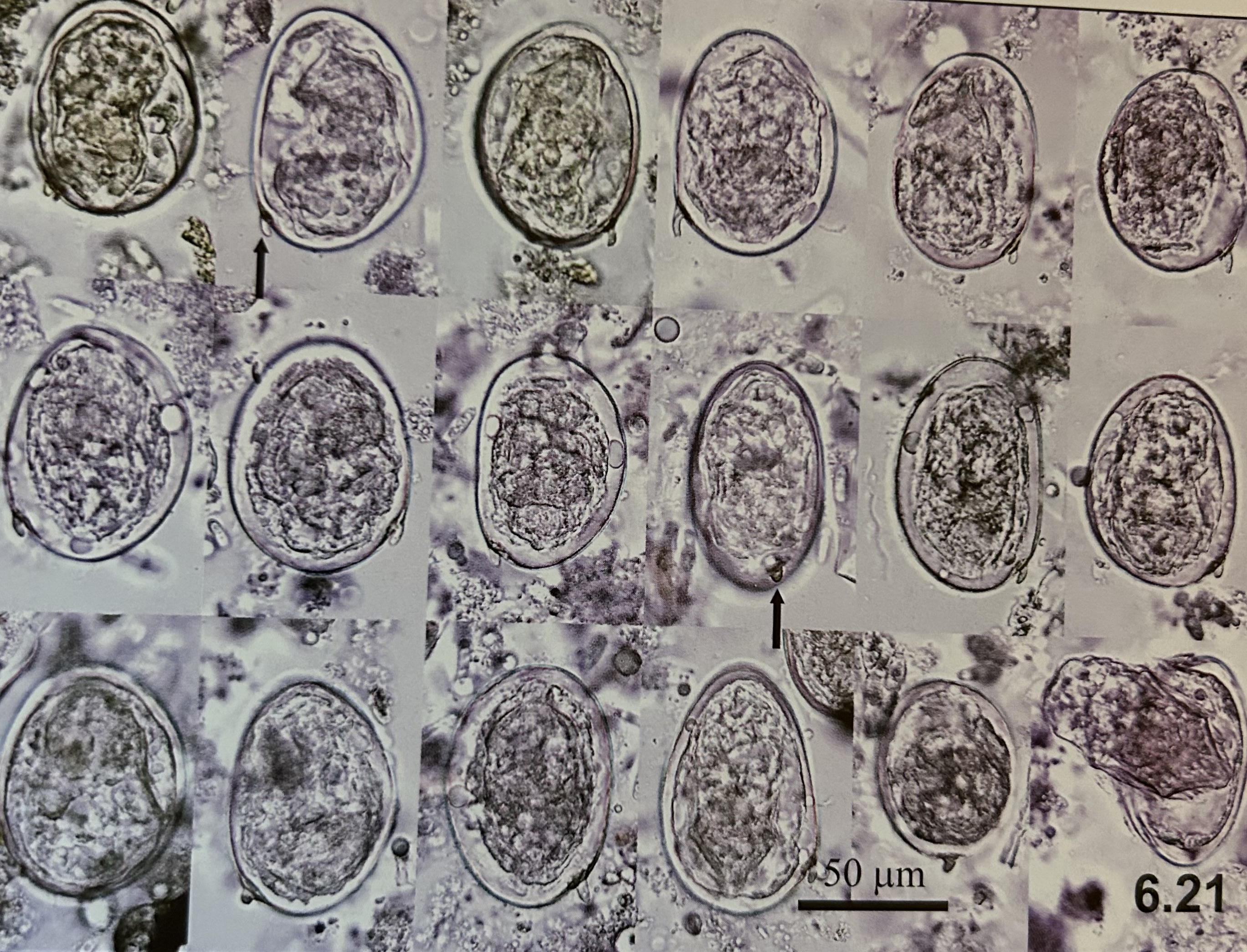 <p>structures of Schistosoma japonicum (eggs)?</p>