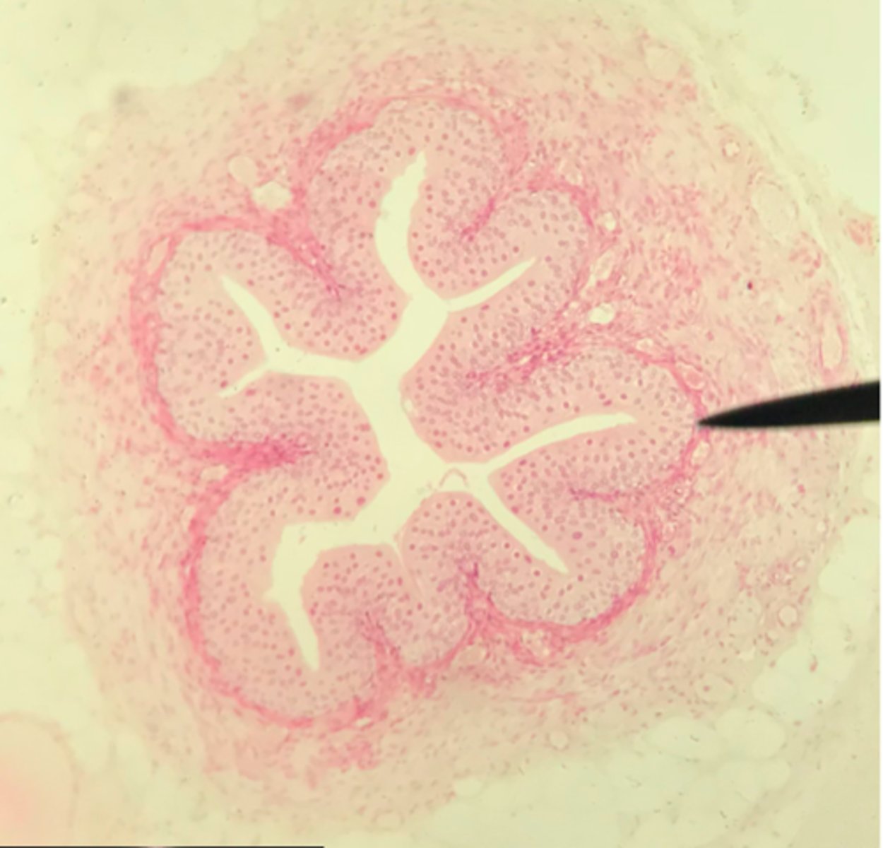 <p>What structure/organ is depicted on this microscope slide?</p><p>What tissue makes up a majority of it?</p>
