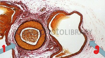 <p>Label the vessels seen here.</p>