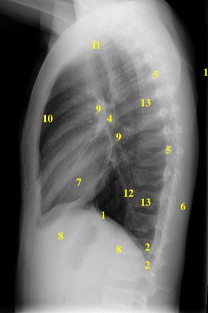 <p>What anatomical structure is number 10?</p>