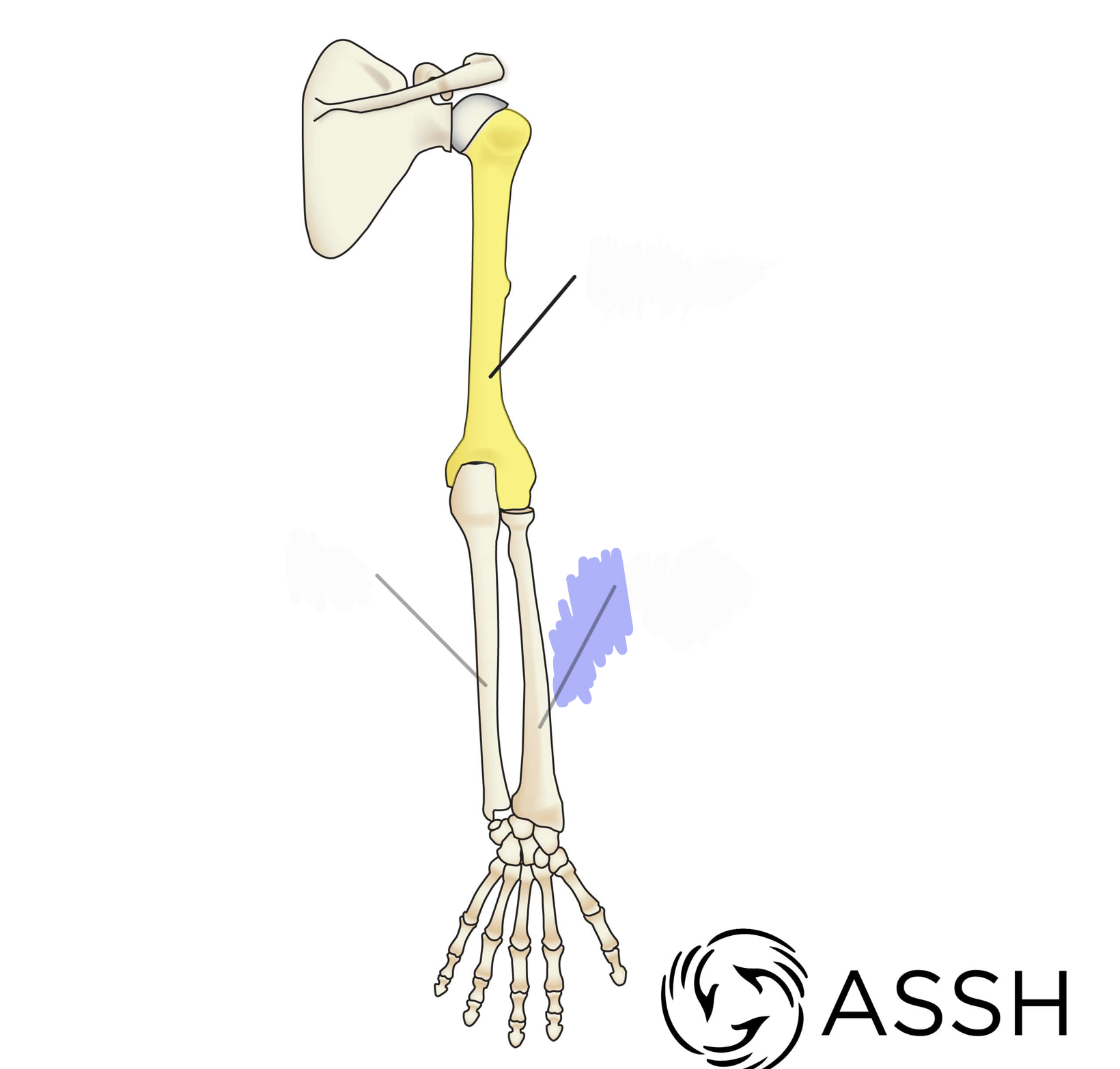 <p>radial tuberosity, styloid process, head; Know right from left</p>