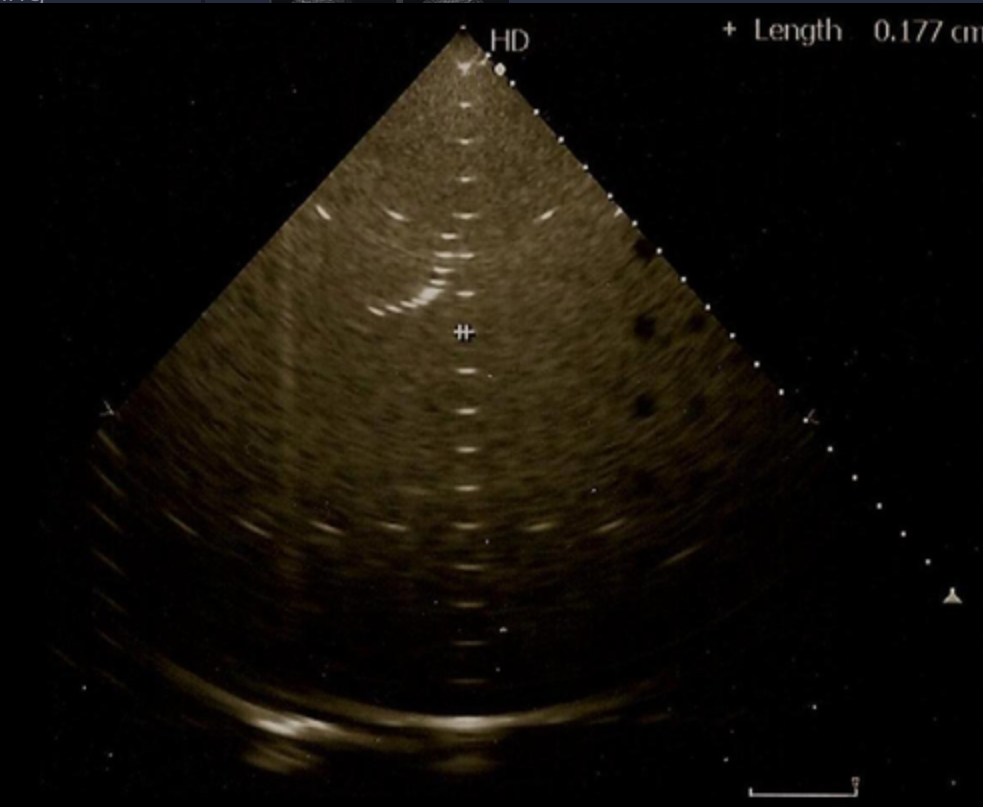 <p>What system parameter is being assessed on the phantom image?</p><p>a. lateral resolution <br>b. axial resolution <br>c. horizontal distance calibration <br>d. depth calibration</p>