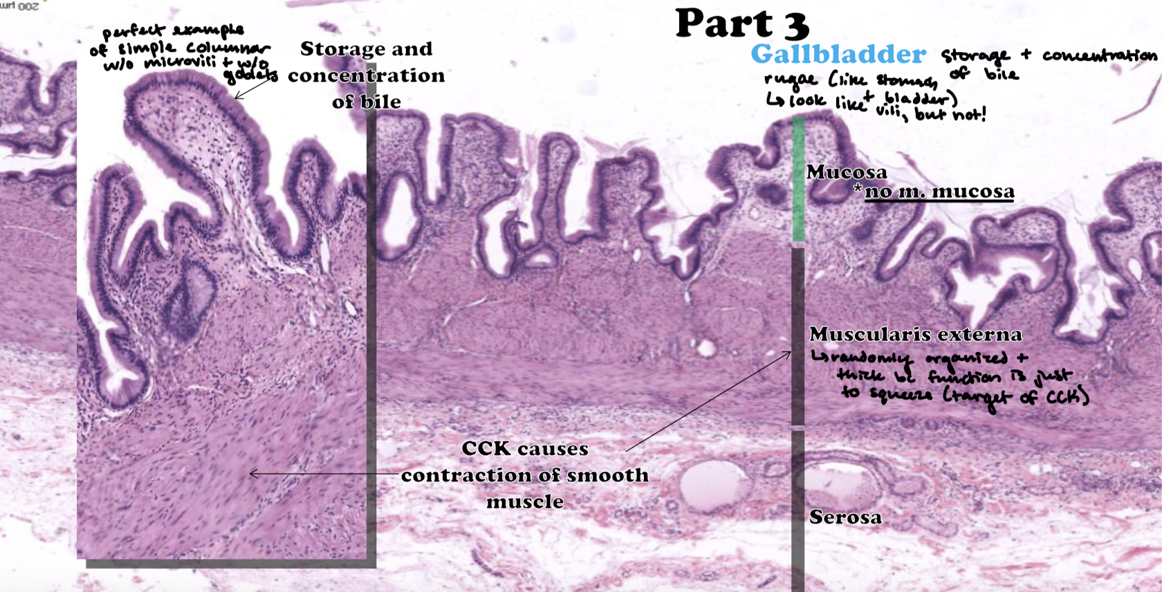 <p>Storage and concentration of bile (adds mucous). Contain rugae of the lamina propria (like the stomach, look like villi but they are not). A perfect example of simple columnar without microvilli and without goblet cells. There is NO muscularis mucosa, and the muscularis externa is randomly organized and thick becasue the function is just to squeeze (the target of CCK).</p>