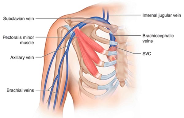 <p>a major vein in the armpit that collects deoxygenated blood from the upper arm and drains into the subclavian vein; begins at the lower border of the teres major tendon and latissimus dorsi muscle</p>