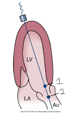 <p>Describe the SVB positions displayed.</p>