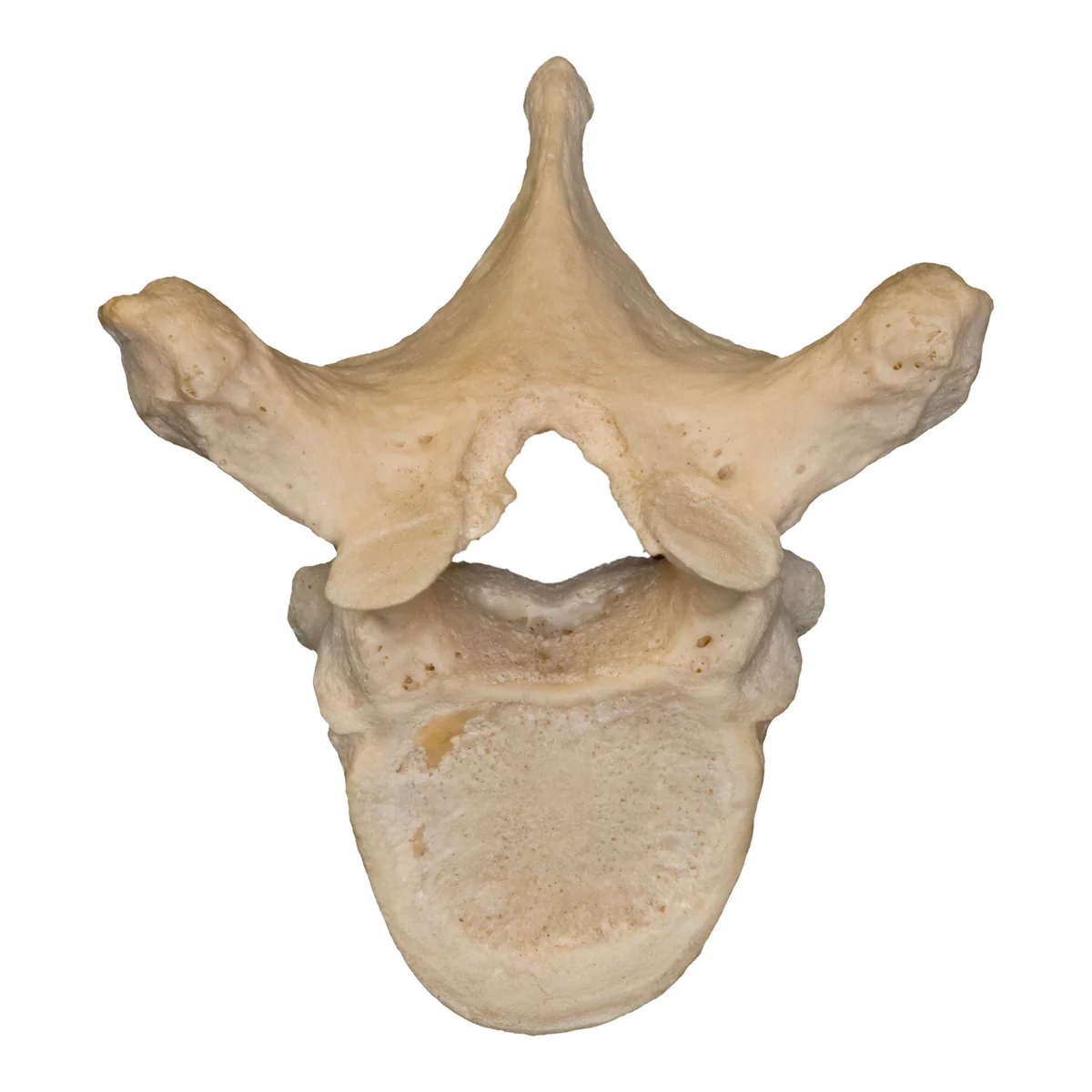 <p>What are the 33 bones of the spinal column?</p>