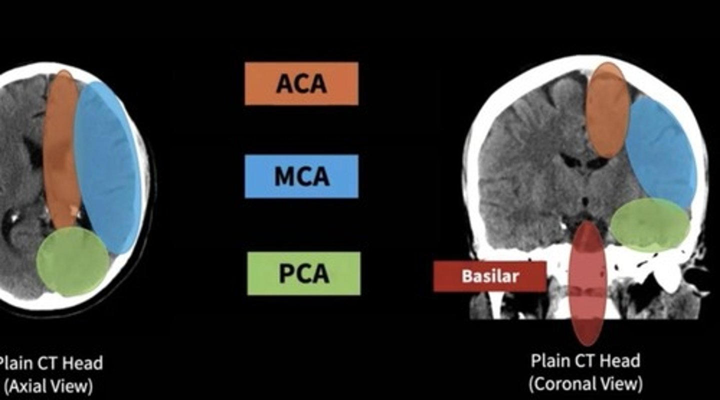 <p>Supplies blood to the medial parts of front + parietal lobes; causes leg weakness</p>