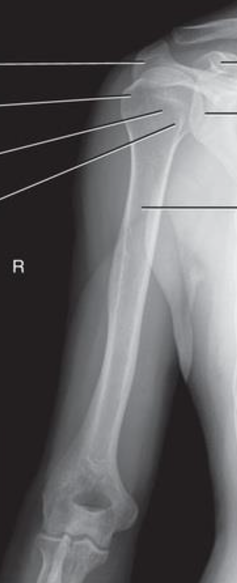 <p>what is this projection </p>