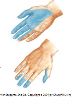 <p>Intrinsic muscles on the lateral side of the hand (think M) </p>